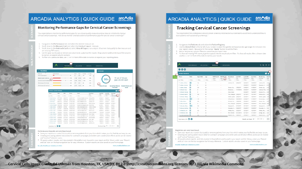ervical Cancer Screenings Quick Guides